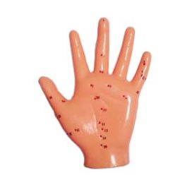 Acupuncture moulage