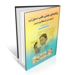 راهنمای عملی طب سوزنی ناحیه سر (اسکالپ) و بدن