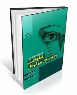 بلفاروپلاستی و جوانسازی پری اربیتال