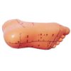 Acupuncture moulage