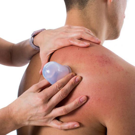 کاپ سیلیکونی بادکش صورت و بدن (۴ عددی)