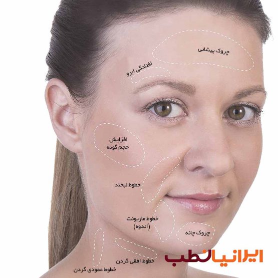 کاپ سیلیکونی بادکش صورت و بدن (۴ عددی)