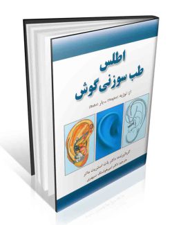 اطلس طب سوزنی گوش دکتر امیر هوشنگ سپهری